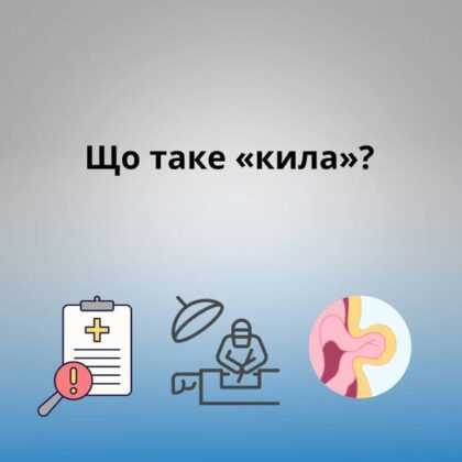 Що таке “кила”